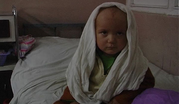 سازمان ملل: یک میلیون کودک در افغانستان با سوء تغذیه رو به رو اند