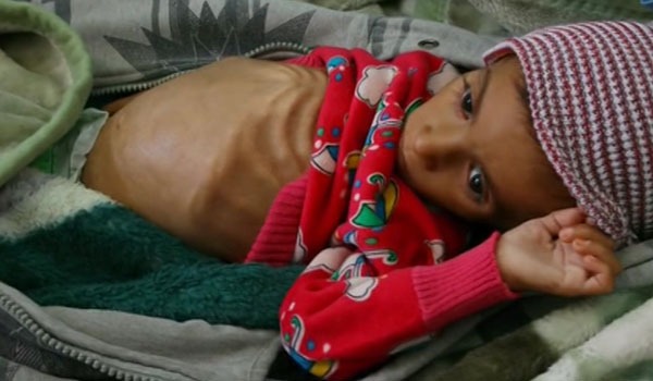 سازمان ملل: کمبود غذا در یمن جان سیزده میلیون تن را تهدید می کند