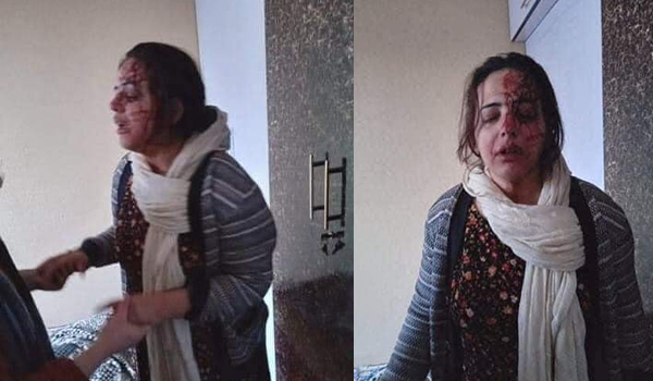 ضرب‌وشتم همسر و دختر یک استاد دانشگاه توسط افراد مسلح در کابل