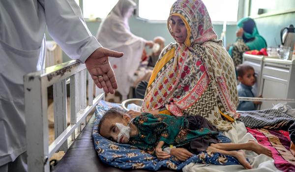 ادارۀ نجات کودکان: شمار کودکان مبتلا به سوء‌تغذیه در افغانستان افزایش یافته است